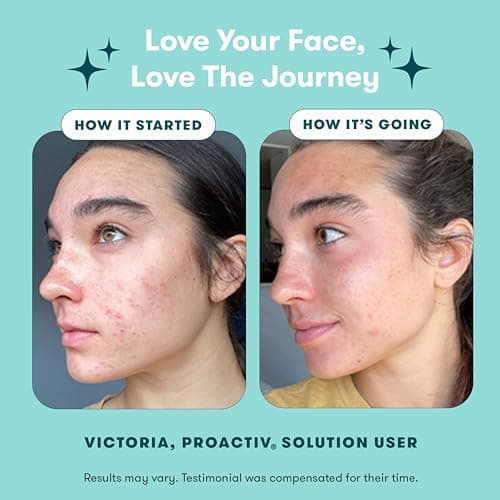Proactiv 3 Step Acne Treatment - Benzoyl Peroxide Face Wash, Repairing Acne Spot Treatment for Face and Body, Exfoliating Toner - 30 Day Complete Acne Skin Care Kit